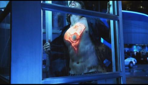 If you keep picking on that giant thing, Clark, it won't start healing.